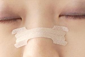 ニキビのお悩みを解消する港北区の医院