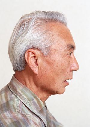 塩尻市のプライマリーケア診療の皮膚科